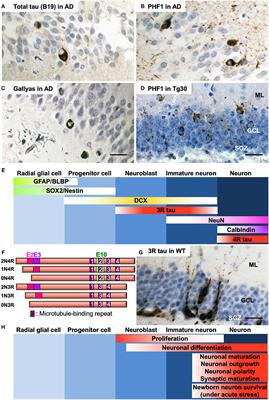 Tau Pathology and Adult Hippocampal Neurogenesis: What Tau Mouse Models Tell us?